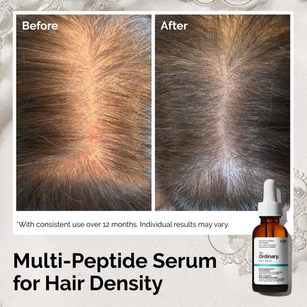 The Ordinary Multi-Peptide Serum for Hair Density for Thicker, Fuller Looking Hair