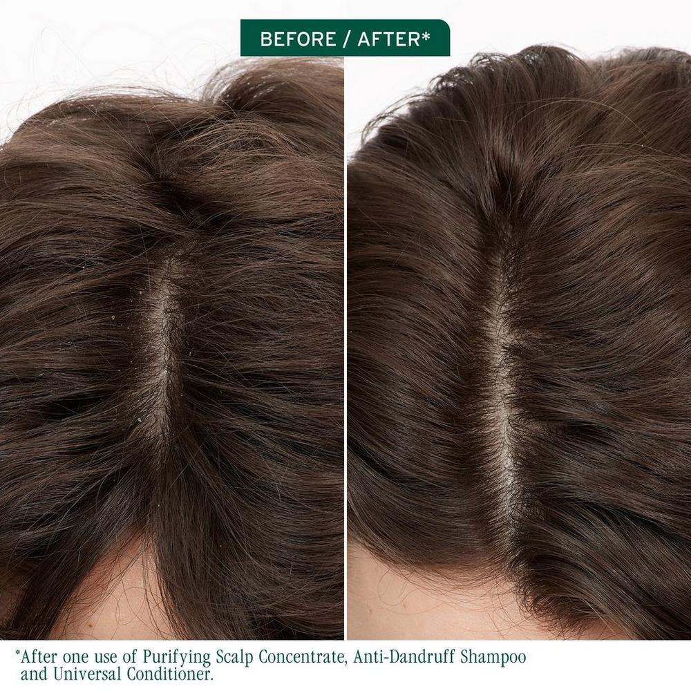 Biolage Scalp Sync Anti-Dandruff Shampoo